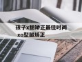 孩子x腿矫正最佳时间 xo型腿矫正