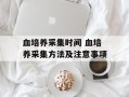 血培养采集时间 血培养采集方法及注意事项