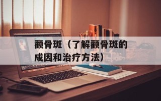 颧骨斑（了解颧骨斑的成因和治疗方法）